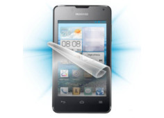 Screenshield™ HUAWEI Nova...