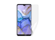 Screenshield IGET BlackView...