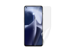 Screenshield ONEPLUS Nord...